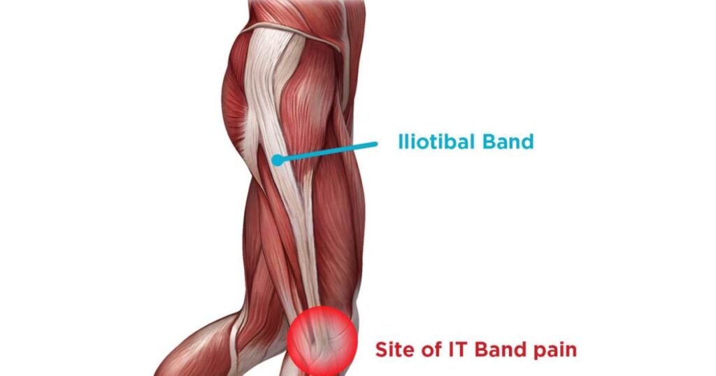douleur au genou causée par la course à pied